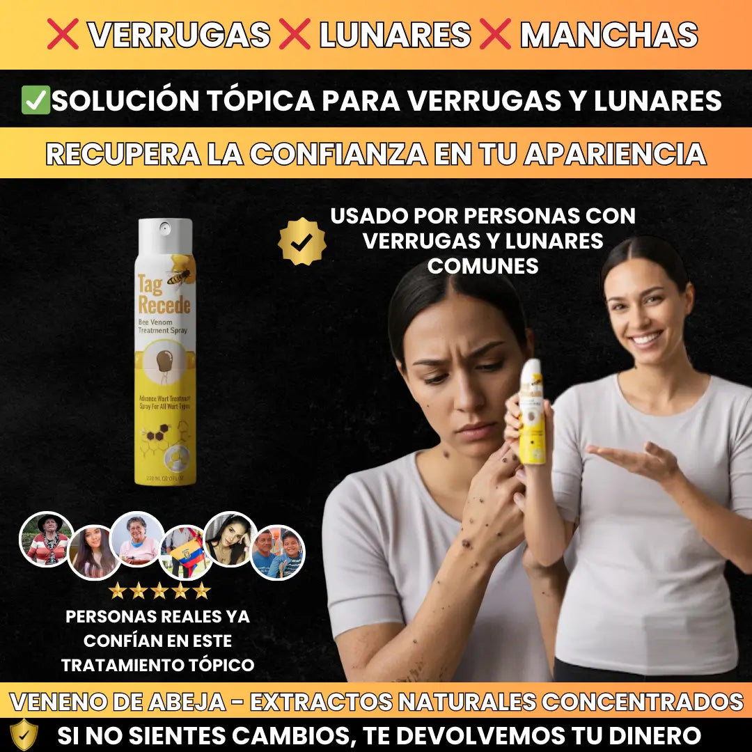 Elimina Verrugas sin Dolor ni Cicatrices
